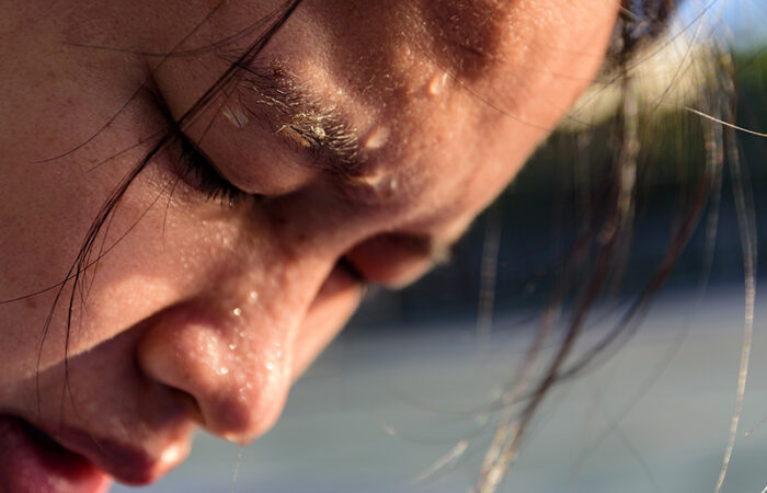 Teenagers Acne Treatment