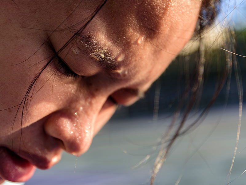 Teenagers Acne Treatment