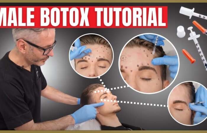 Male Botox Tutorial