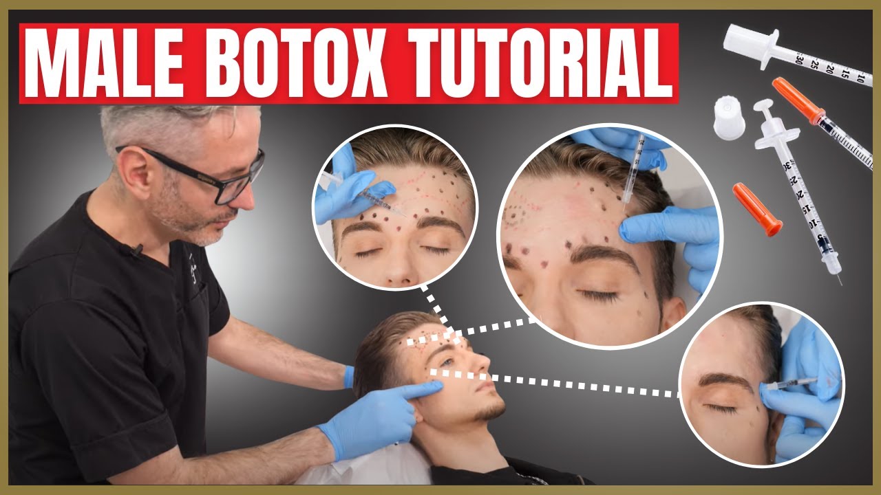 Male Botox Tutorial