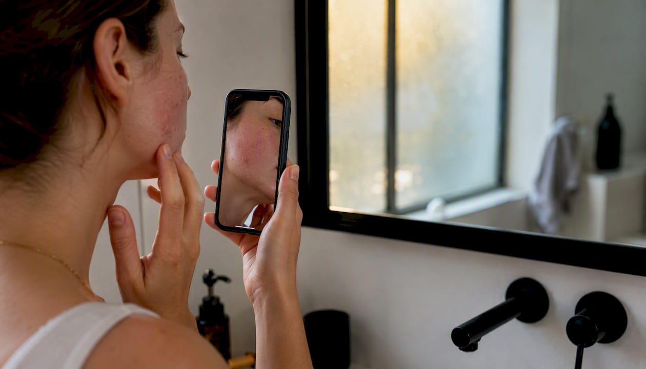 Patient photographing treated skin area