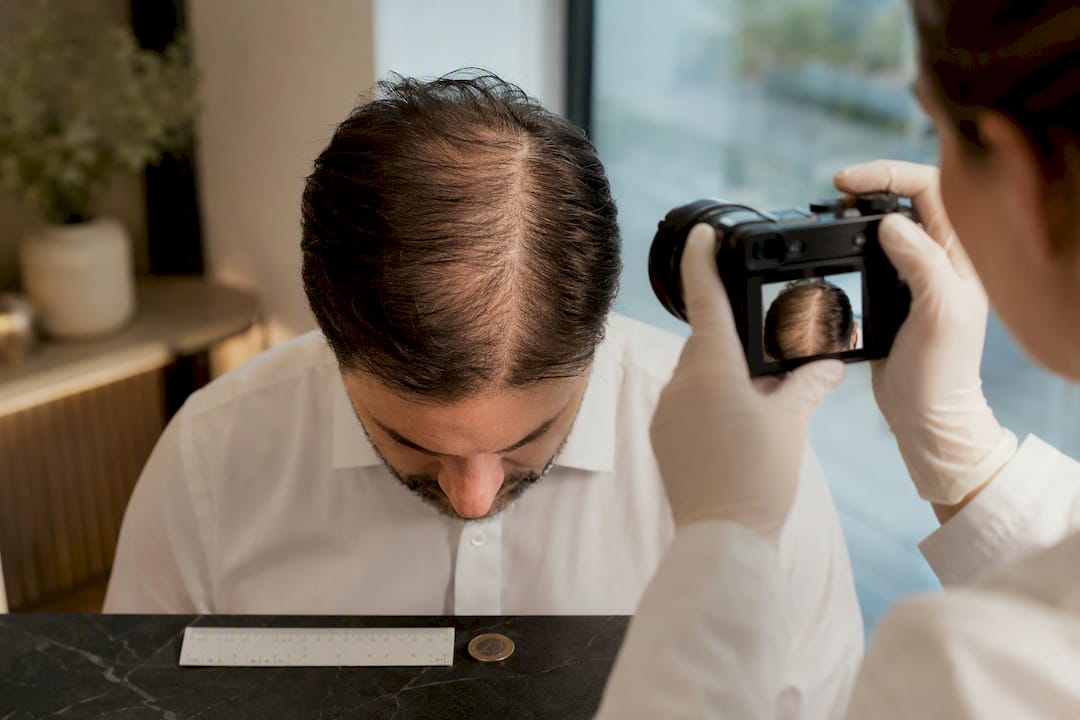 Clinician taking standardized scalp photograph