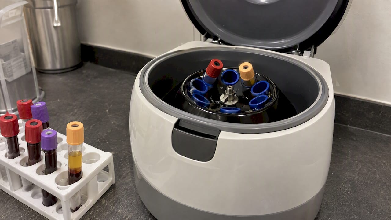 Centrifuge and tubes used in PRP preparation