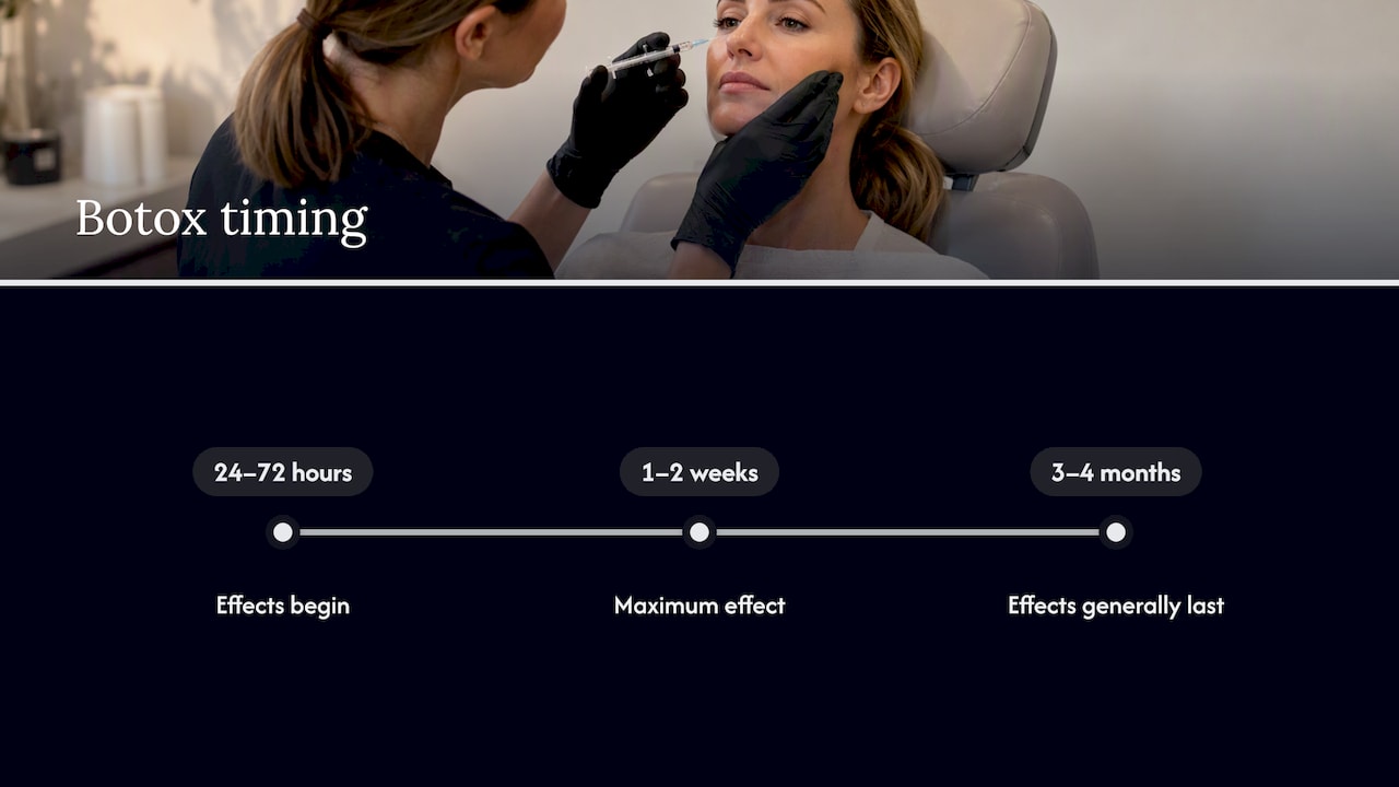 Timeline of Botox onset peak and duration